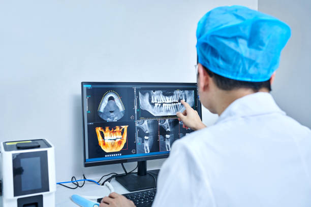 Best Emergency Wisdom Tooth Extraction in Litchfield, MN